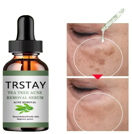 Sérum Hydratant Anti-Acné, Réduction des Pores et Soins de Peau